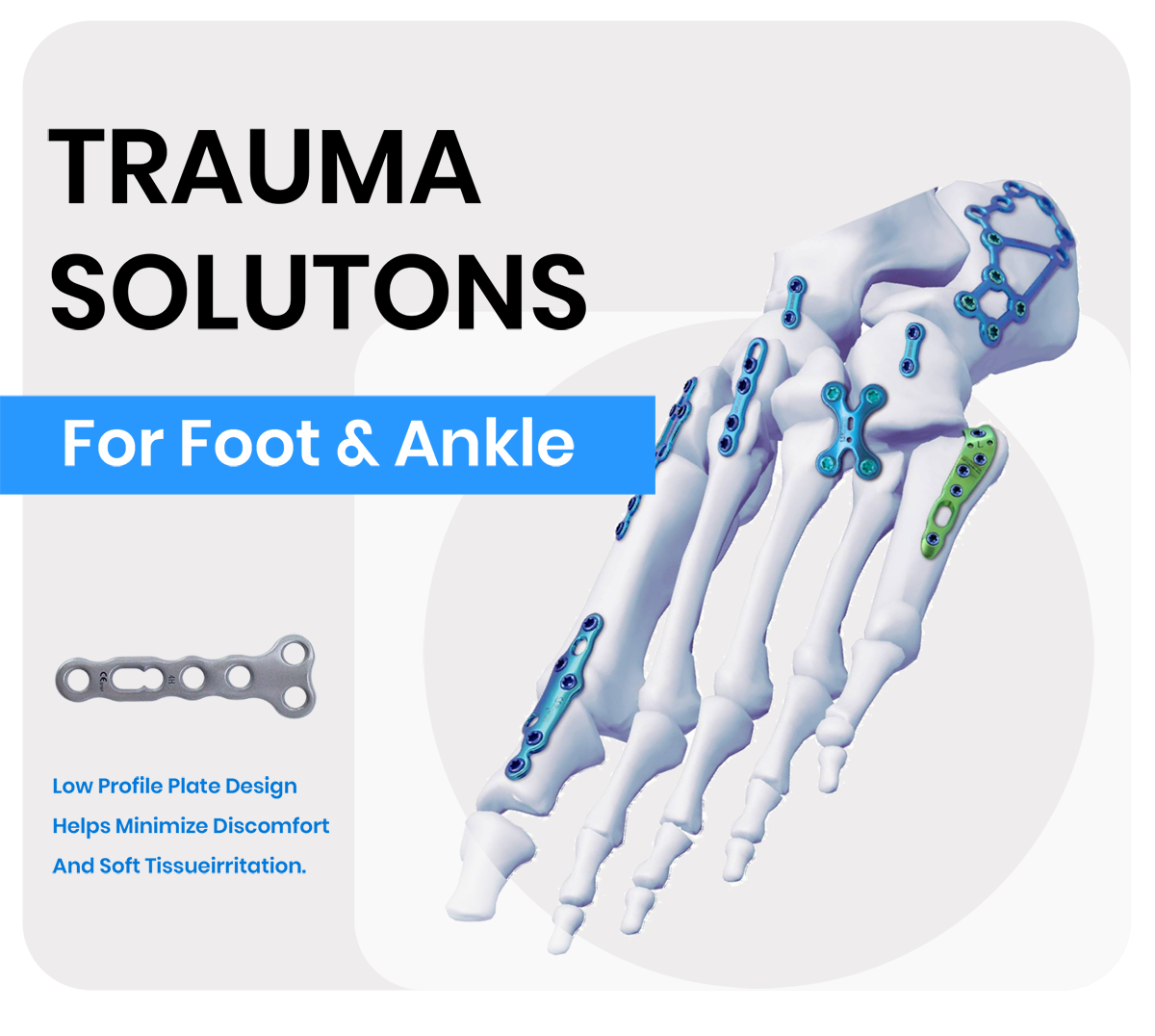 foot and ankle locking plate system (3) enkola ya pulati y’okusiba ebigere n’enkizi (3) .