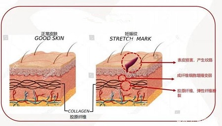 acetyl glucosamine in skin care - ZHENYIBIO