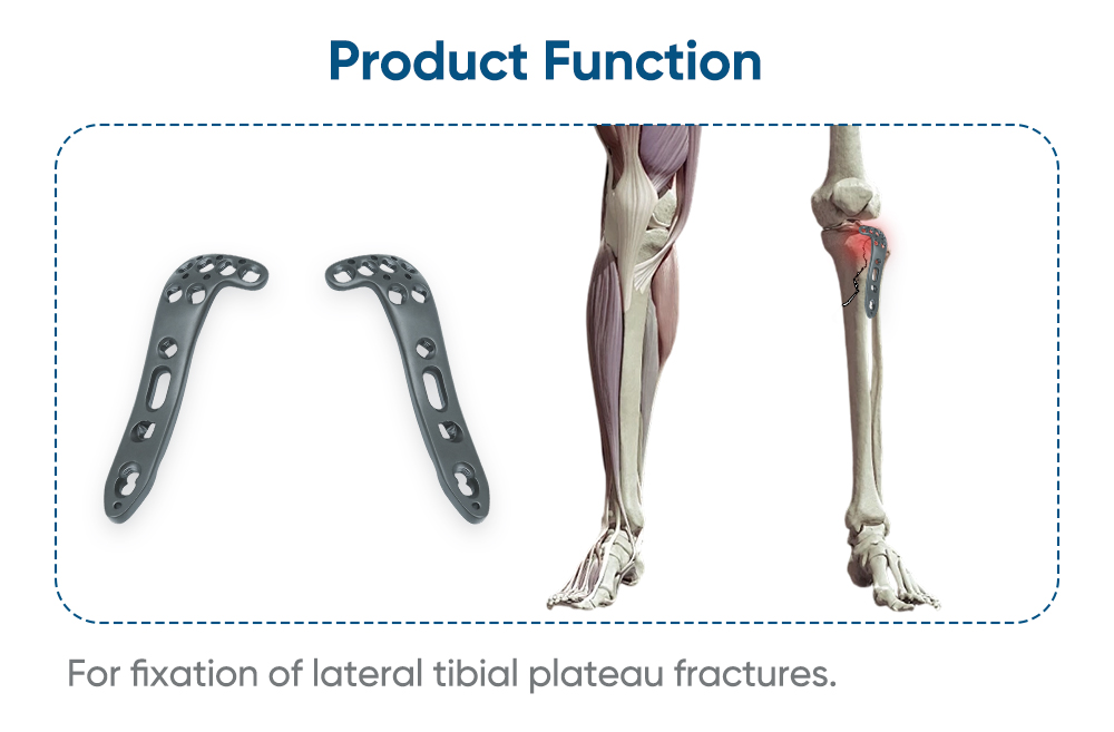 Lateral Polyaxial Locking Plate for Tibial Plateau - Buy Product on XC Medico Placa de Bloqueo Poliaxial Lateral ukaxa Meseta Tibial ukataki - XC Medico ukanxa Producto alaña