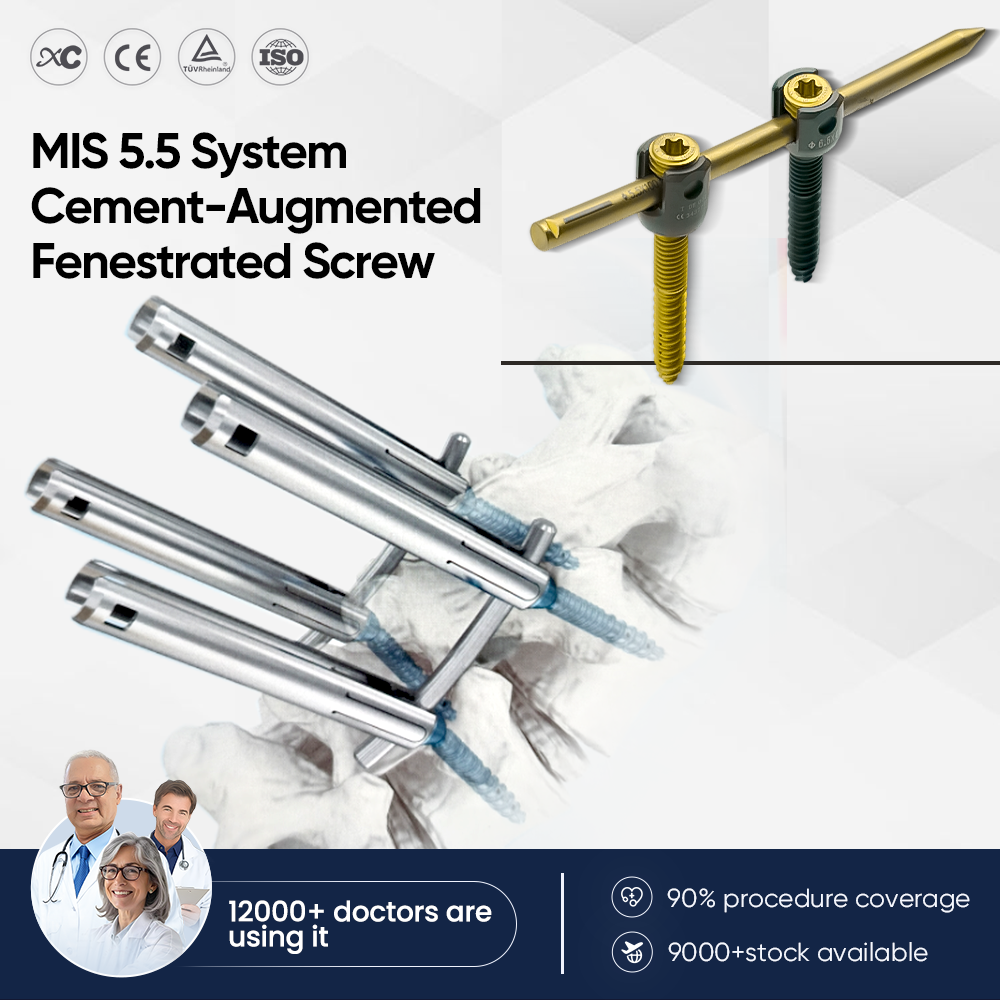 MIS 5.5 Zement-augment&eacute;iert fenestr&eacute;iert Schraube
