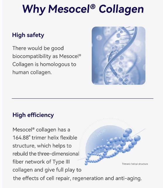 why Mesocel Type Ⅲ Collagen Injection
