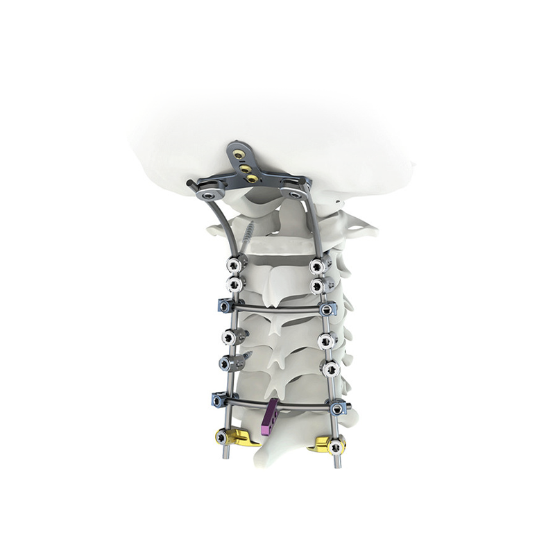 पोस्टरियर ग्रीवा फिक्सेशन सिस्टम