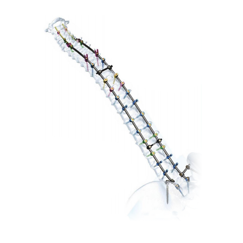 स्पाइनल स्टॅबिलायझेशन सिस्टम उघडा