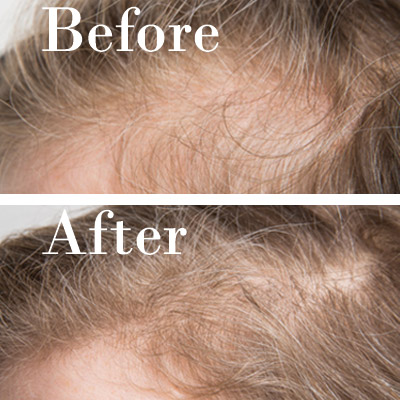copper peptide hair care-ZHENYIBIO