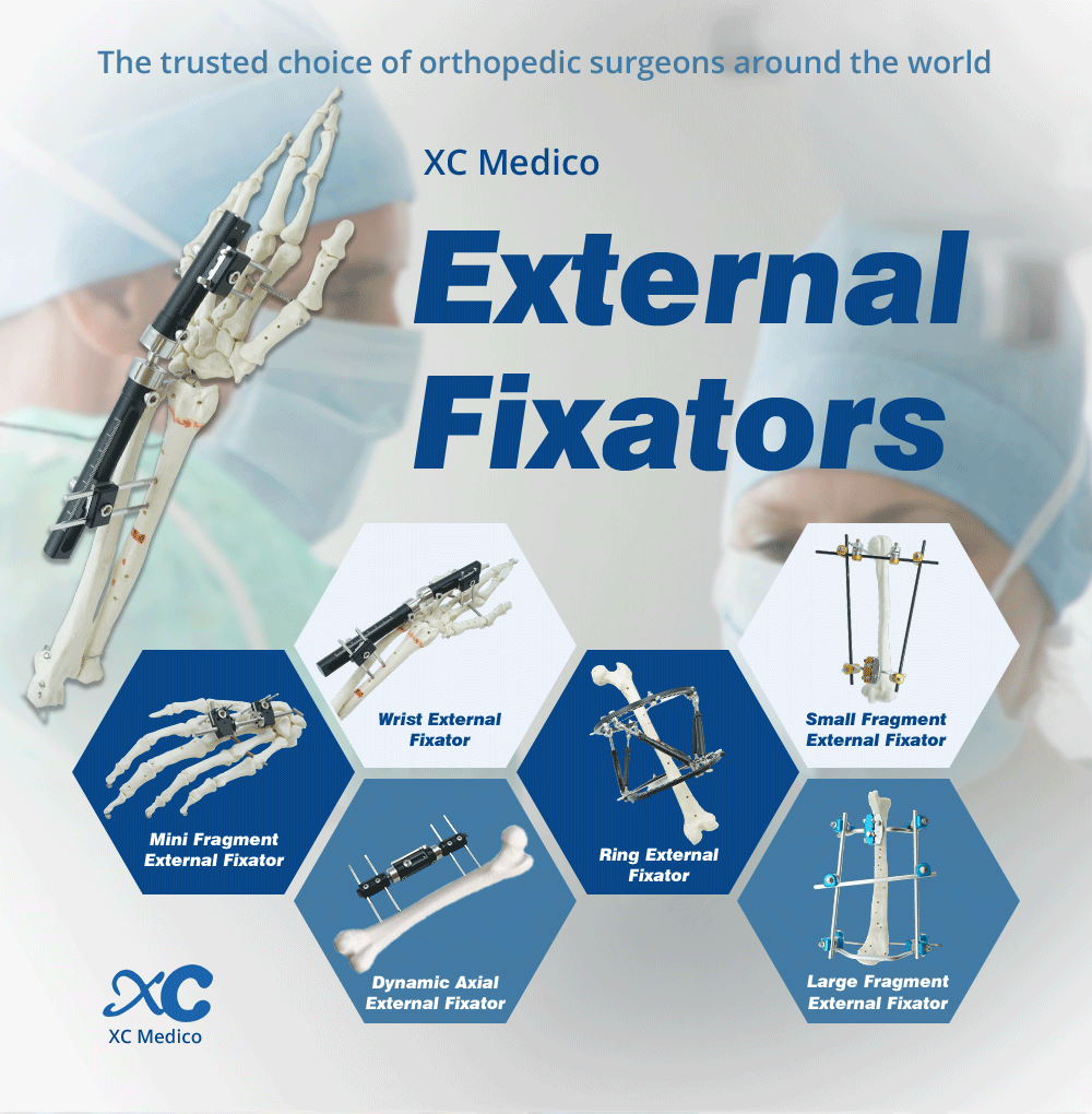 Fixator Ita Ọwọ - Ra ọja lori XC Medico