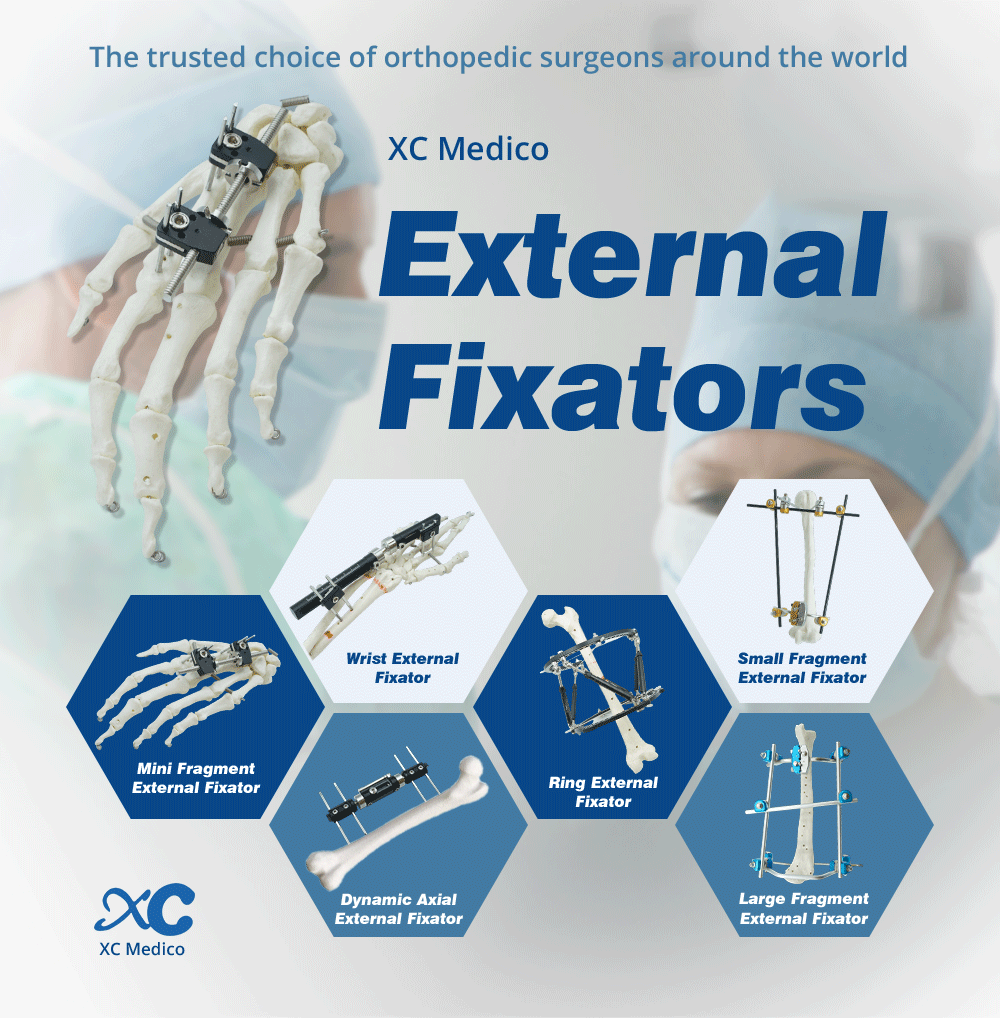 External Fixation Ntawm Metacarpals Thiab Phalanges - Duab 1