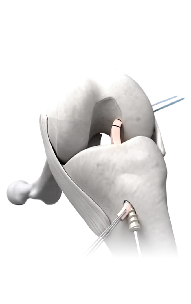 Спорт медицинасы