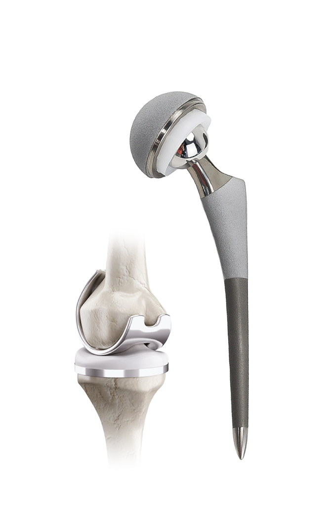 Биргелешкен кайра куруу