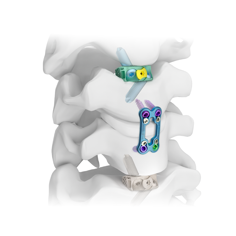 पूर्ववर्ती ग्रीवा प्लेट प्रणाली