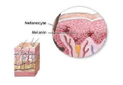 Efectos de Melanotan II