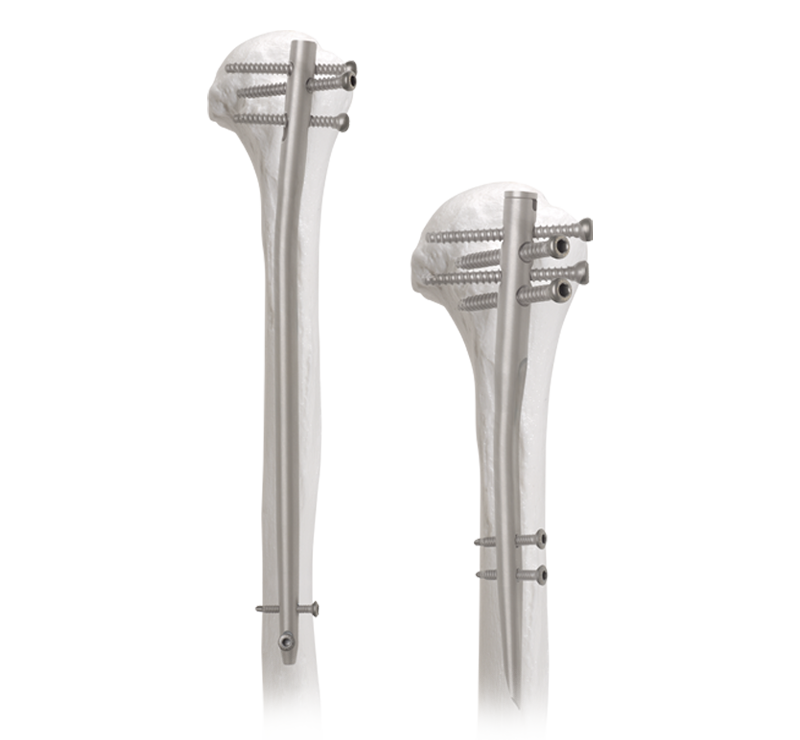 humeral_ligádo_sistema_0-xtuicha .