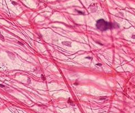 Was ist Acetyltetrapeptid?