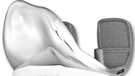 XM-PS FEMALAL CONDYLAR-1