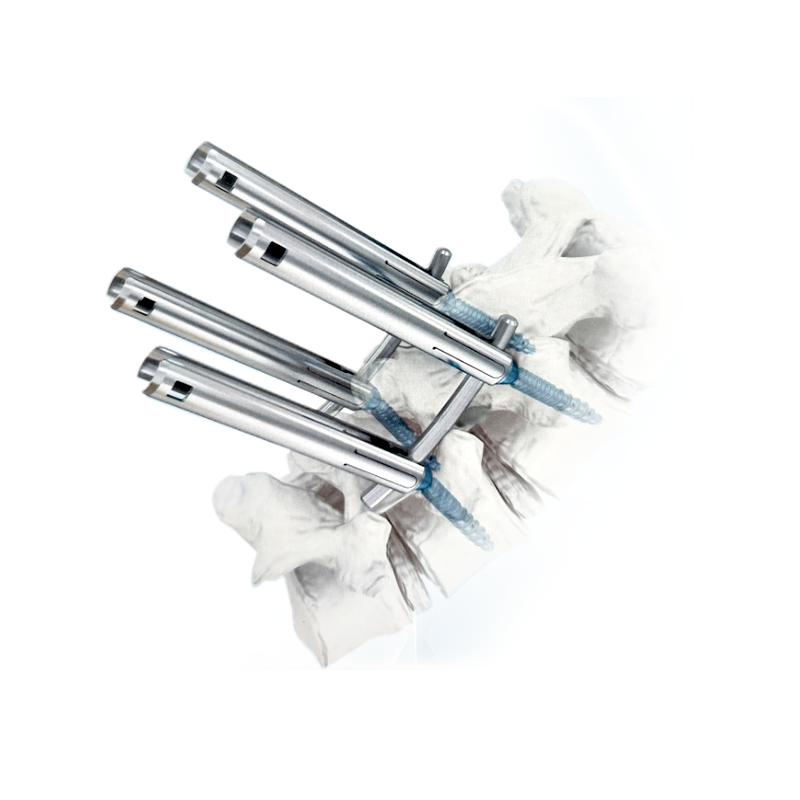 एमआयएस स्पाइनल फिक्सेशन सिस्टम