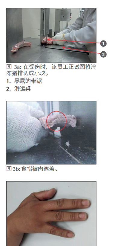 The Real CASE: Employees had their fingers cut off because without the protective gloves