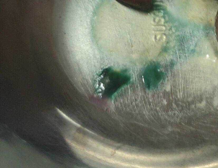 Does Stainless Steel Turn Skin Green