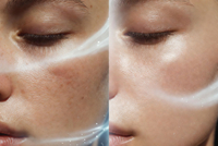 //a0.ldycdn.com/cloud/plBpjKqlllSRplkkijlliq/Oxygen-Optimization-Skin-Transformation.jpg