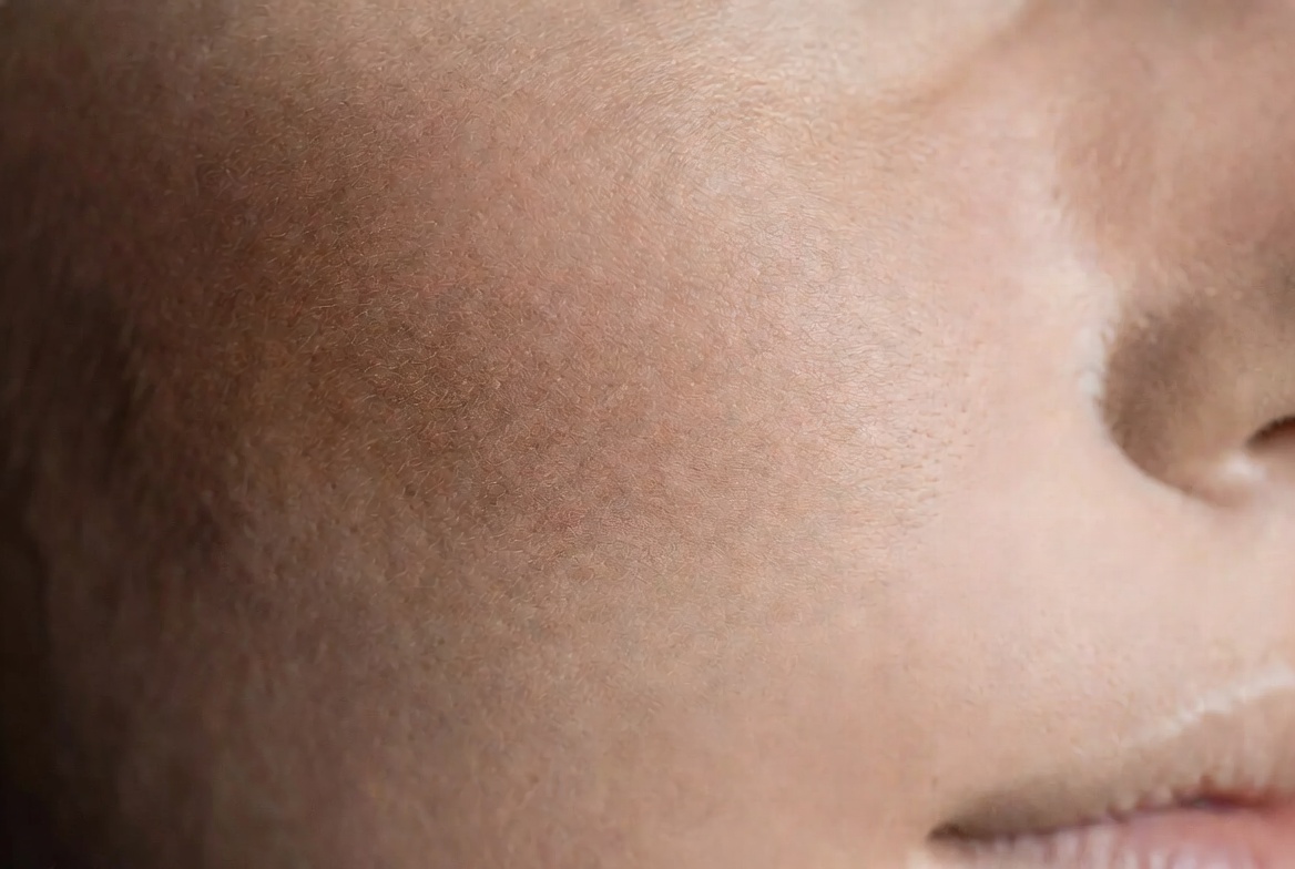 Skin Tone Radiance Comparison